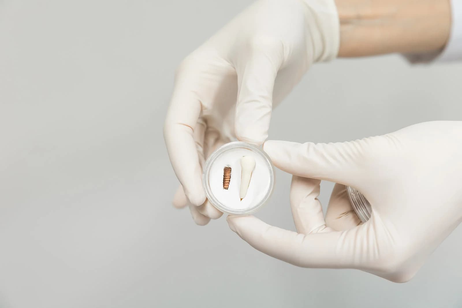 ESTÉTICA DENTAL